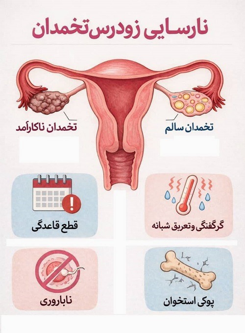 یائسگی زودرس