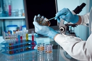 طراحی روش ELISA مبتنی بر پروتئین نوکلئوکپسید نوترکیب برای سنجش آنتی بادی های IgG و IgM انسانی علیه SARS-CoV-۲